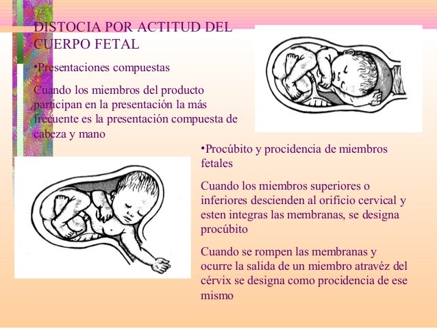 Si y aumentar realmente el miembro más