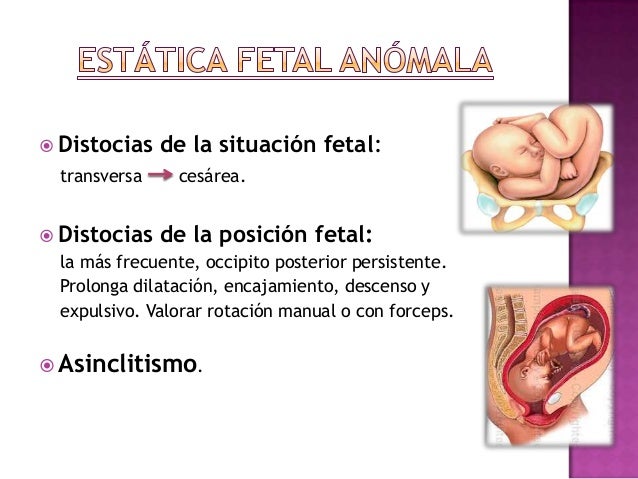 Distocias del parto