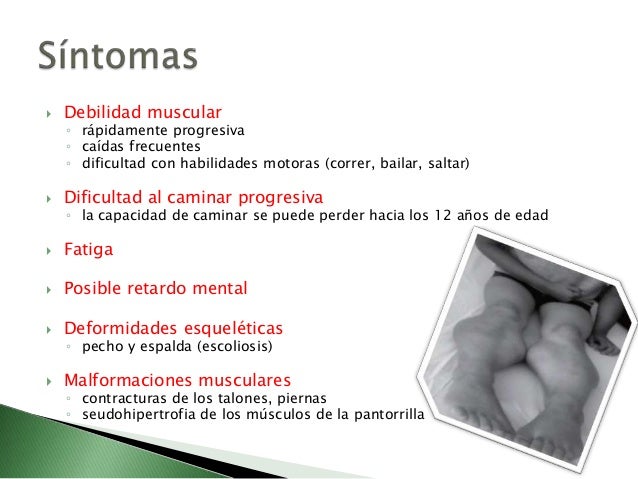 Pin Distrofia-muscular-de-duchenne on Pinterest Pin Distrofia-muscular-de-duchenne on Pinterest