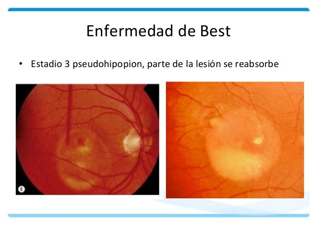 El blanqueamiento de la cutis la cosmética