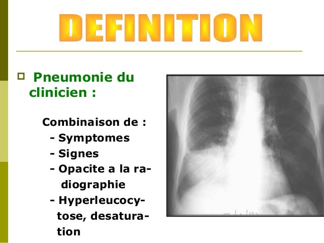 Les dorsalgies quand jaspire