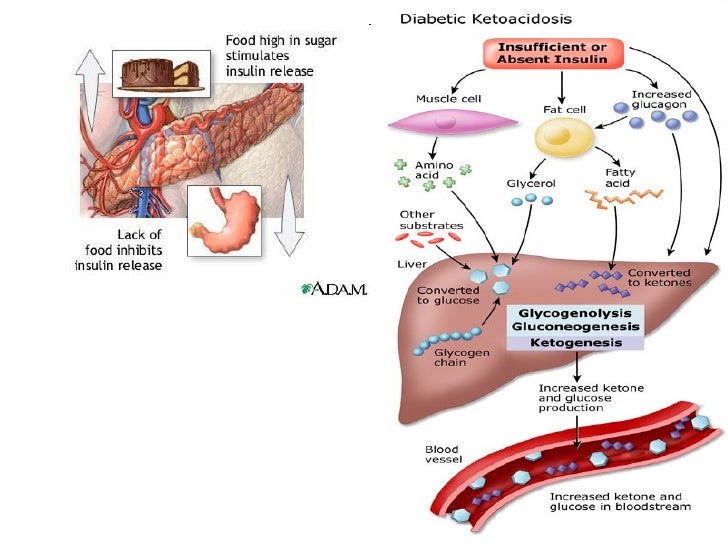 Why no diabetic ketoacidosis in type 2