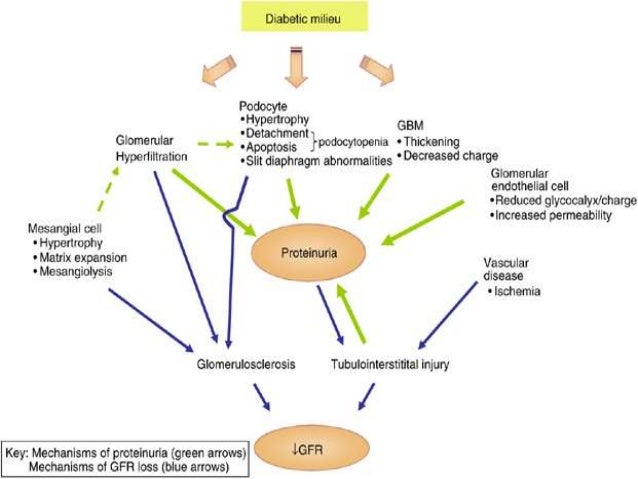 Proteinuria In Diabetes All Articles about Ketogenic Diet