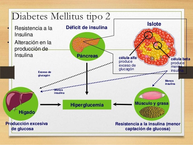 Diabetes Mellitus tipo 2 Diabetes Mellitus tipo 2
