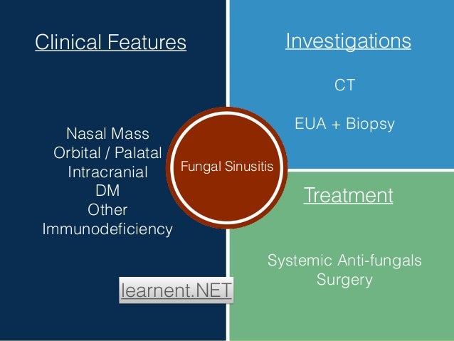 Nasal polyp surgical operation reviews mild continual maxillary sinus disease