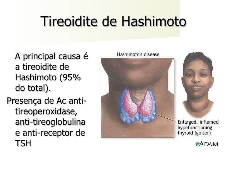 Trasnochas, intenta perder peso rapido con la dieta dukan comidas perder peso rapido con la dieta dukan