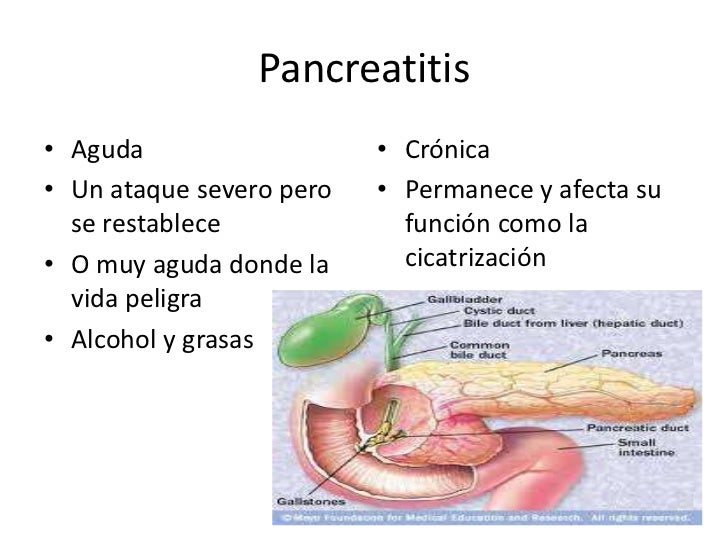 El tratamiento de la hernia de la columna vertebral sin operación en novosibirske