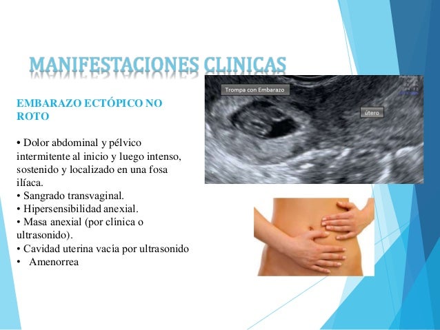Duele la espalda estando al ordenador