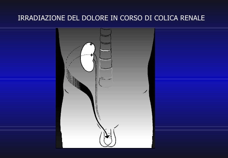 Se è possibile guarire emorroidi senza operazione da rimedi di gente