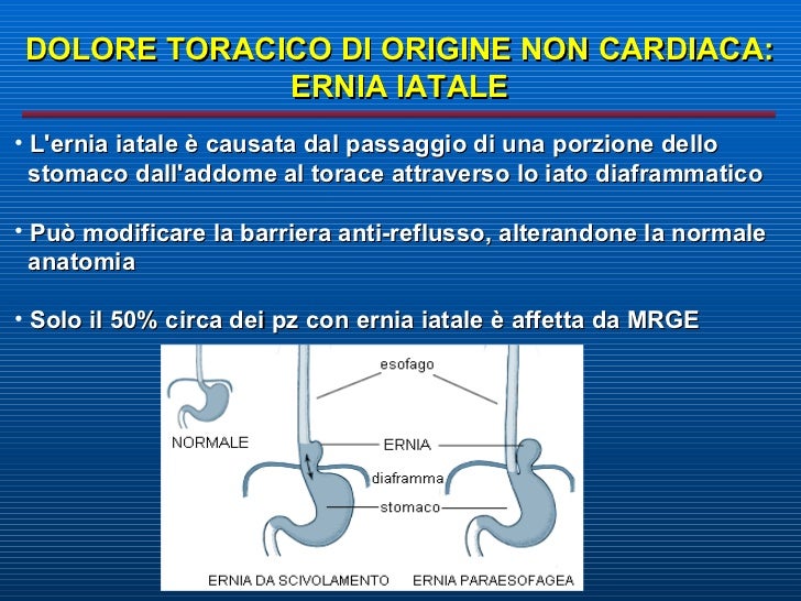 Candele a incrinature ed emorroidi a gravidanza
