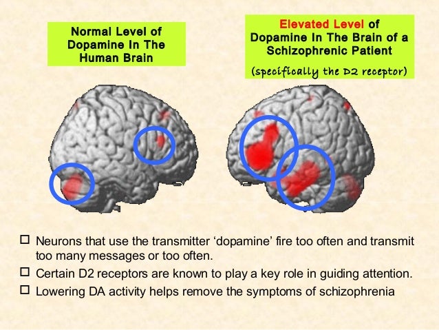 dopamine hypthesis Implications of the dopamine hypothesis of schizophrenia: version iii the hypothesis that the final common pathway is presynaptic dopamine dysregulation has some. dopamine hypthesis Implications of the dopamine hypothesis of schizophrenia: version iii the hypothesis that the final common pathway is presynaptic dopamine dysregulation has some.