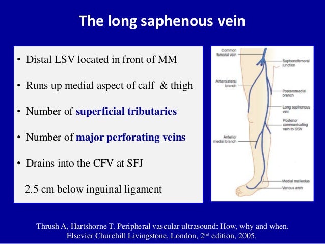 Doppler ultrasound in deep vein thrombosis