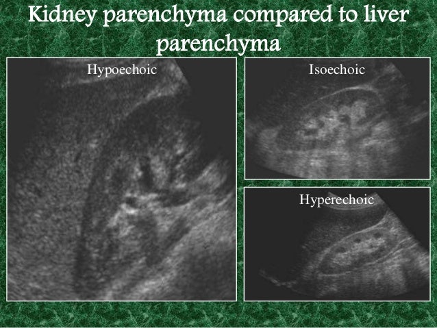 renal artery doppler ultrasound renal artery doppler ultrasound
