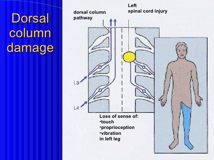 Dorsal column pathway