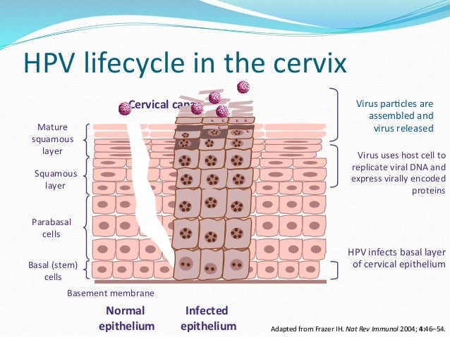 youtube symptoms of cervical cancer most cancers of cervix prevention