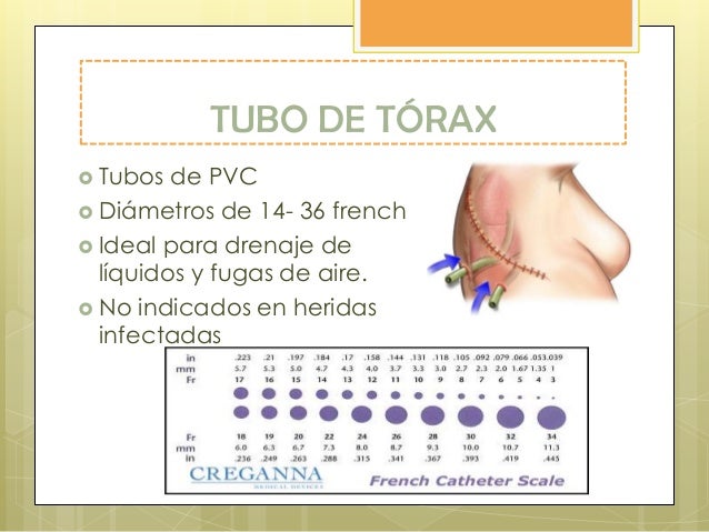 Manejo del espacio pleural