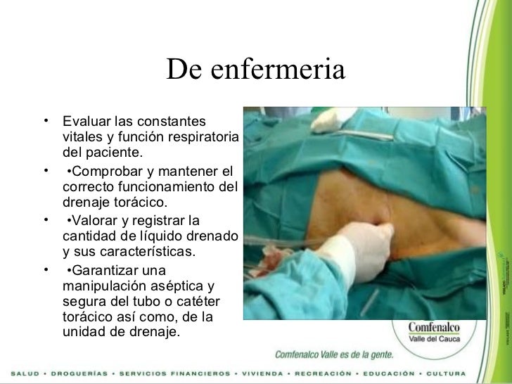Drenajes toracicos equipos