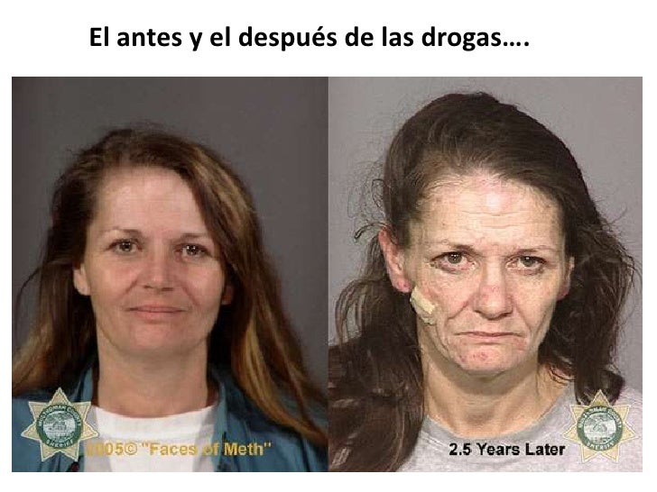 Si dejar beberá los antibióticos antes que