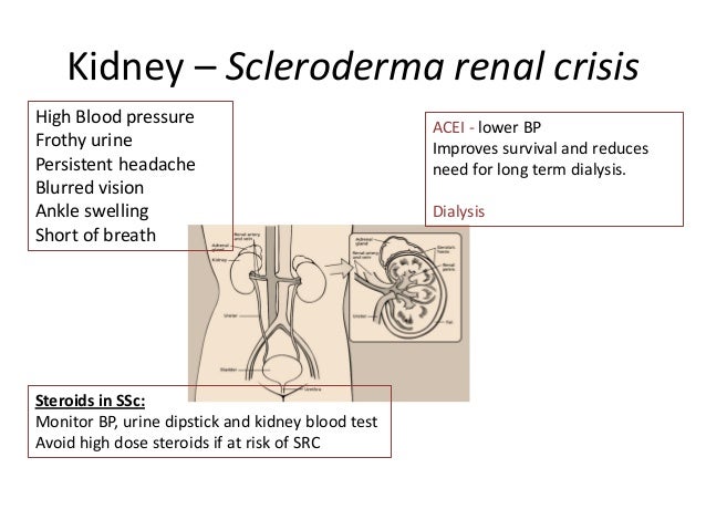 Viagra and kidney function