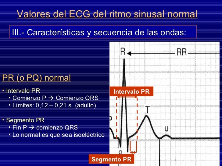 Electrocardiograma