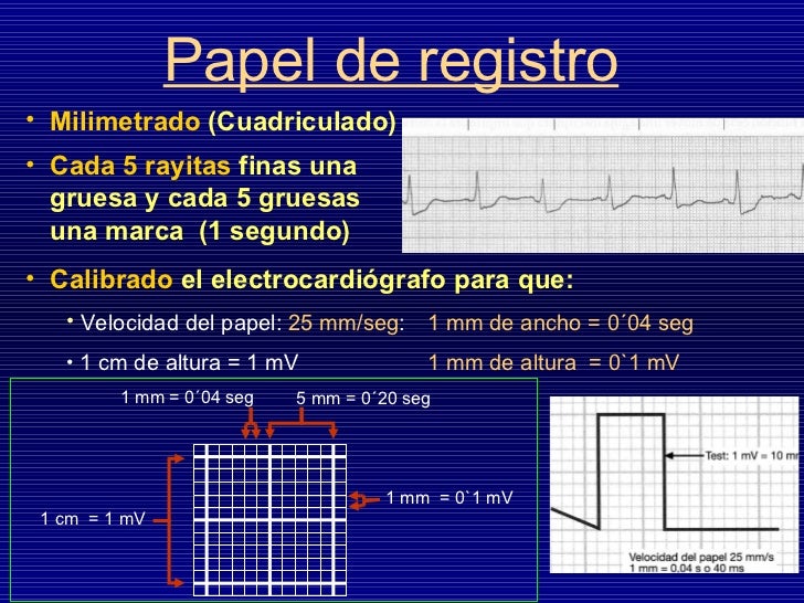 Electrocardiograma