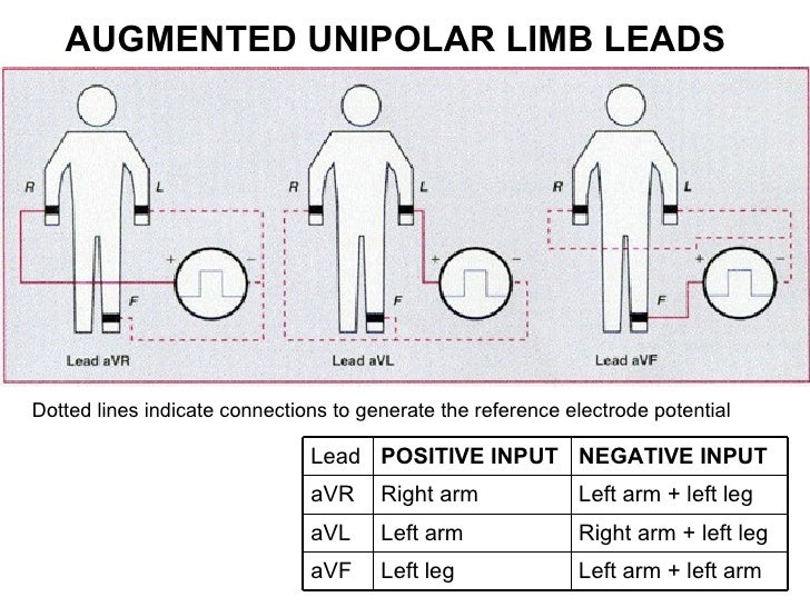 Ecg lecture