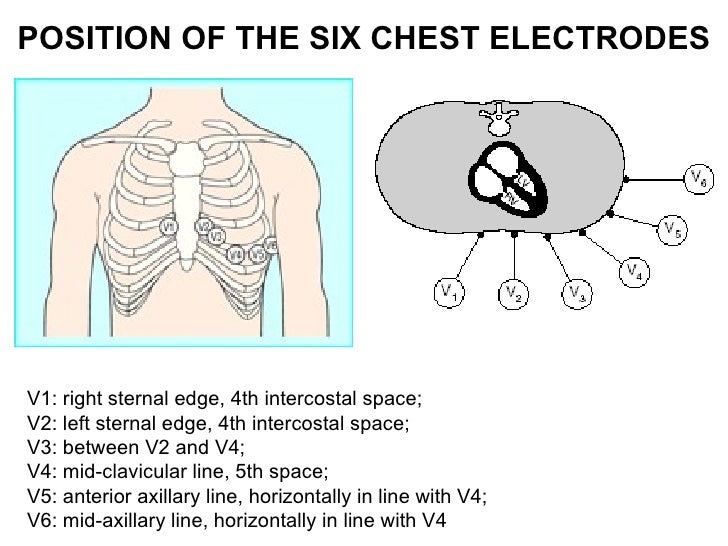 Ecg lecture