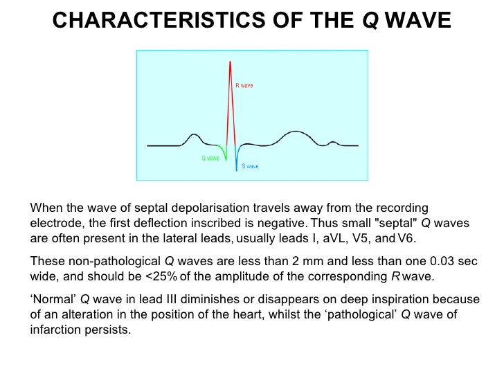 Ecg lecture