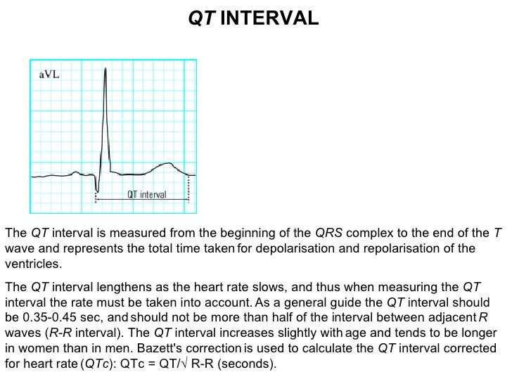 qt interval normal