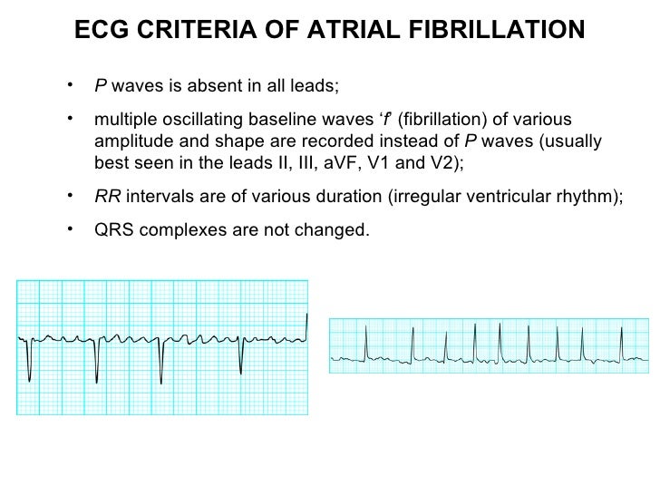 Can A Dog Detect Atrial Fibrillation Can A Dog Detect Atrial Fibrillation