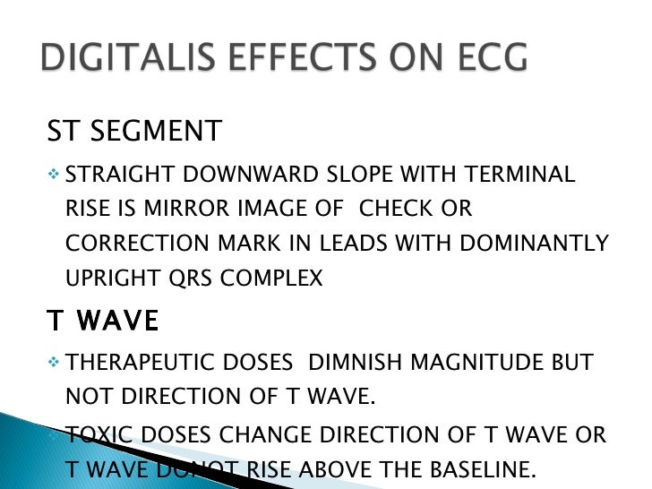 ECG Digitalis Effect