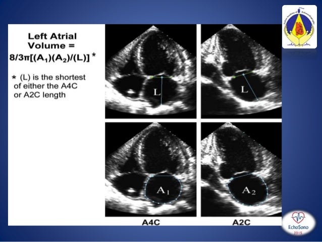 pediatric echo measurements technique z score