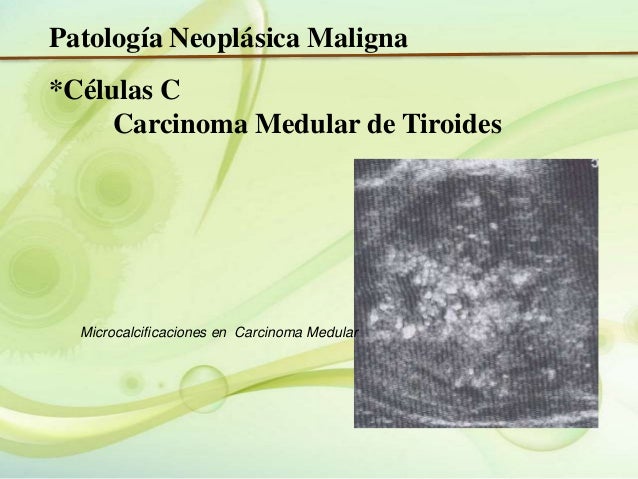 Ecografia de tiroides Ecografia de tiroides