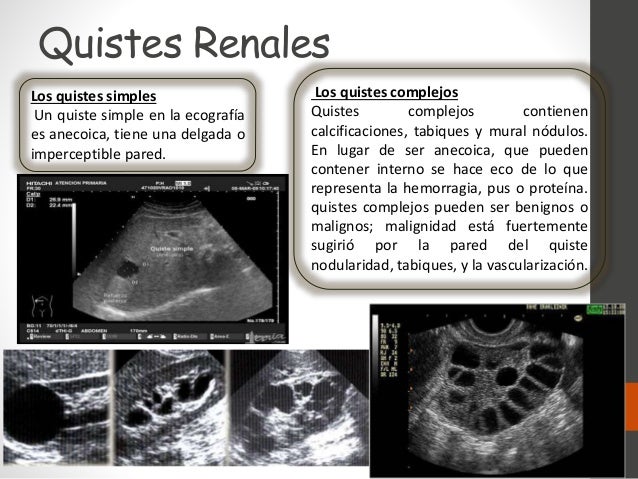 Ecografia renal