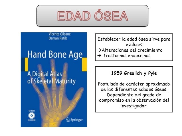 Edad osea