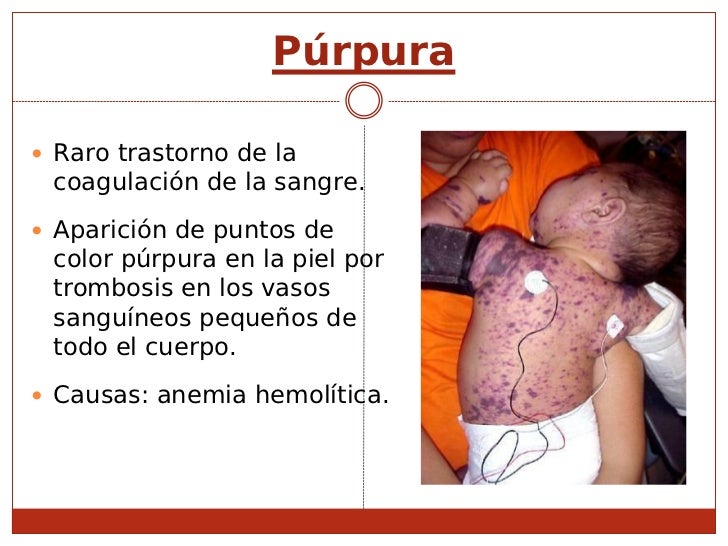Las máscaras que clarifican para la persona de las pecas