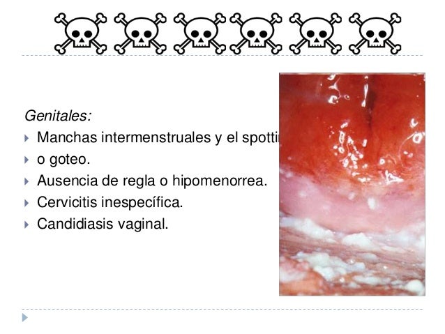 Adelgazo la leche materna