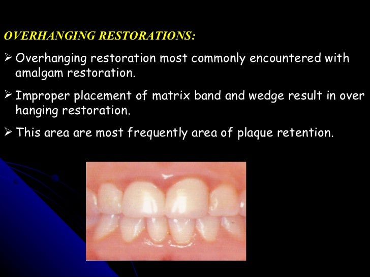 Effects of restorative procedure on periodontium