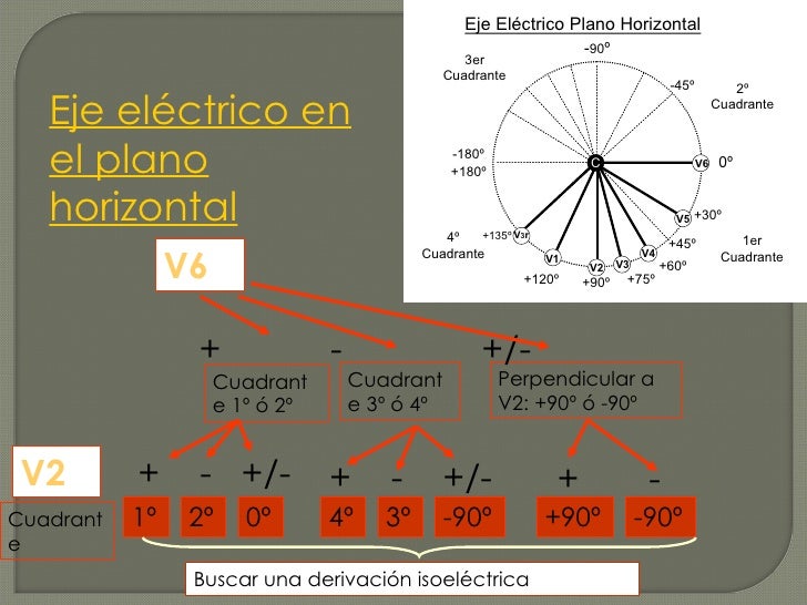 EKG - Eje electrico