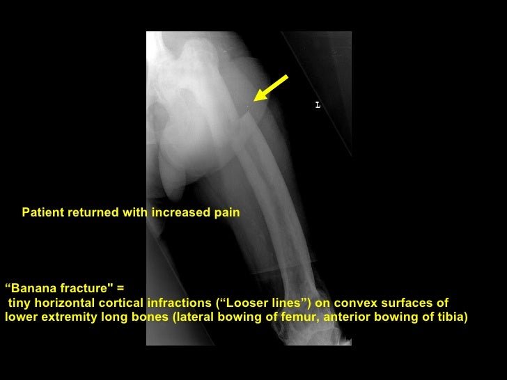 Radiology Rounds: Elderly male with leg pain