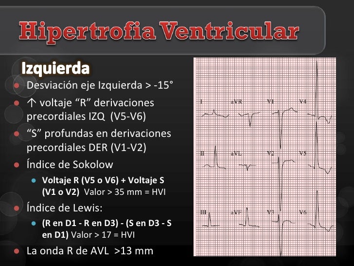 Electrocardiografía clínica