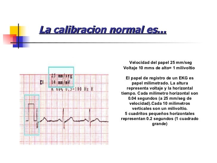 Electrocardiograma