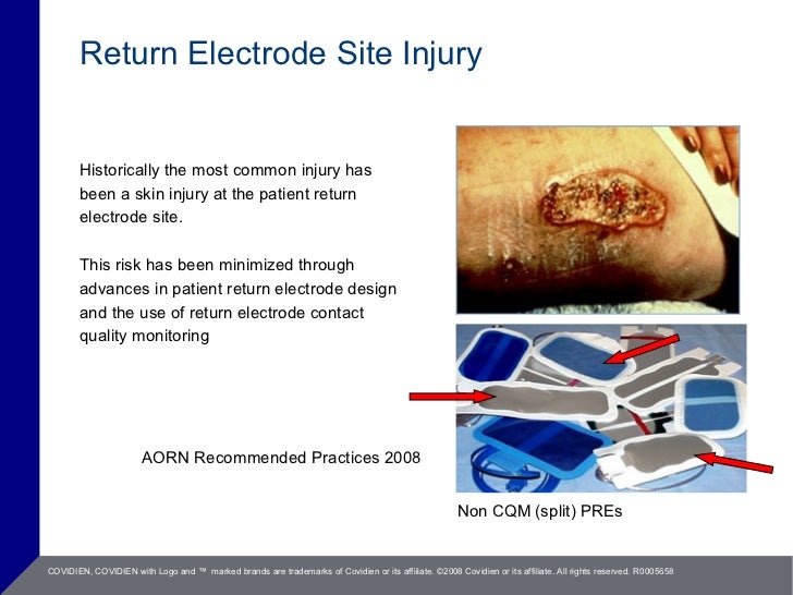 Electrosurgery Saftey