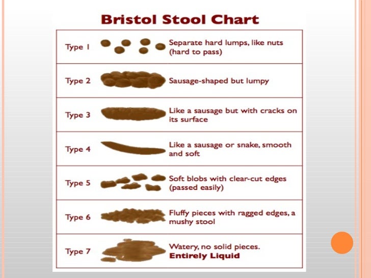 Elimination summer 2012