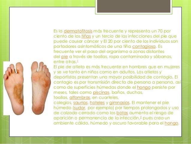 Que curar el hongo entre los dedos de los pies y las manos