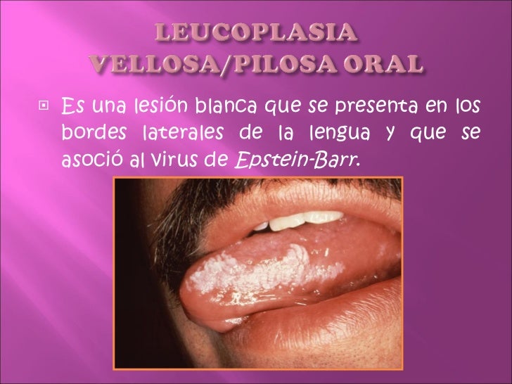 Duele la espalda a las inclinaciones hacia abajo