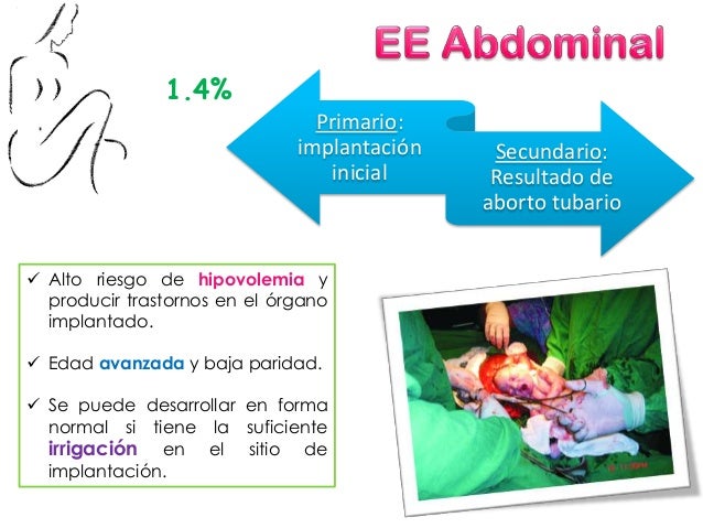 Las pastillas para el adelgazamiento del café verde el precio