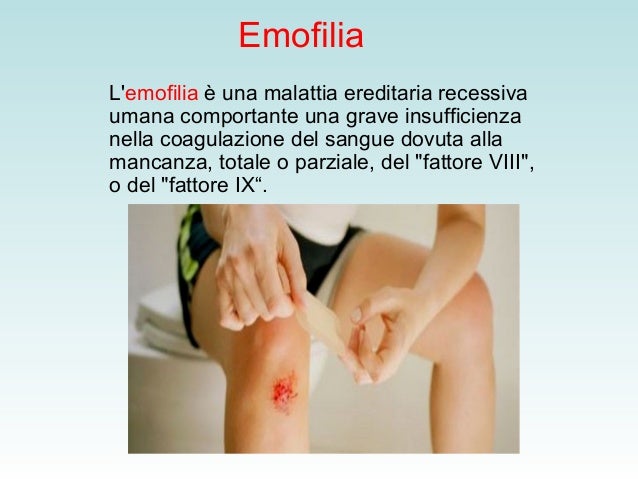 Emofilia