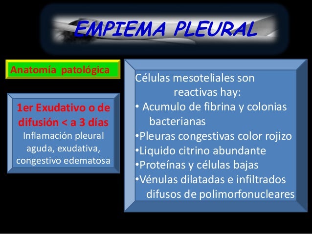 Empiema pleural