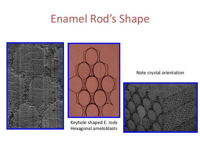 Enamel sectioned oval diagram 